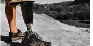 Prosthetics Foot