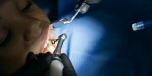 Kids Dentistry Kollam