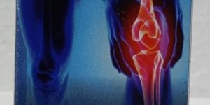 Lifeyco Jointcure Tablets