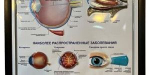 Medical 3D Embossed Poster