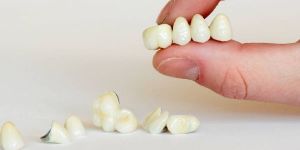 Dental Zirconia Crown