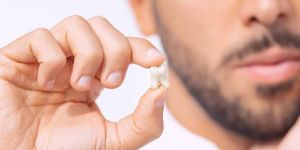 Wisdom Tooth Extraction