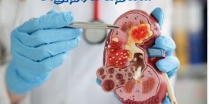 Kidney Stone Homeopathy Treatment