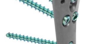 Locking Philos Plate