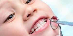 Kids Dentistry Services