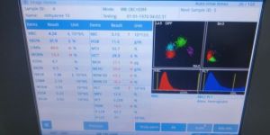 Cell Counter Dirui Hematology Analyzer