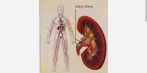 Ayurvedic Kidney Medicine