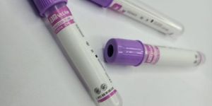 K3 EDTA Non Vacuum Blood Collection Tube