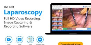 Visualscopy Prime Endoscopy Reporting Software