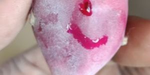 Increase Hemoglobin Iron Supplement