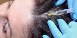 PRP Hair Treatment Service