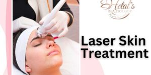 Laser Skin Treatment