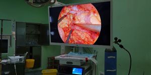 Surgical Camera