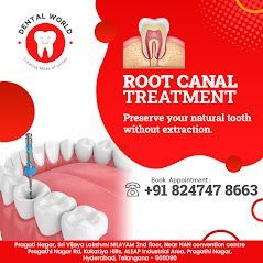 Root Canal Treatment