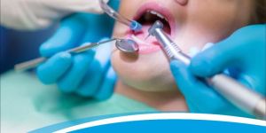 Root Canal Treatment