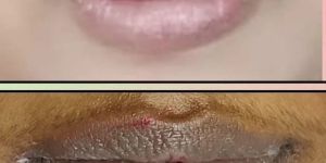 Permanent Lip Color Treatment