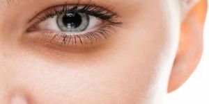 under Eye Dark Circles Treatment