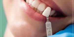 Kids Dentistry
