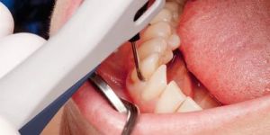 Dental Treatment Service