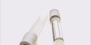 Fluoride Non Vacuum Blood Collection Tube