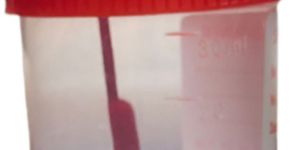 Stool Sample Container