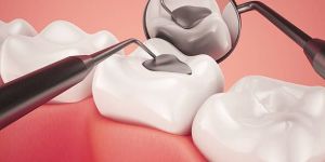 Digital Dental Xrays