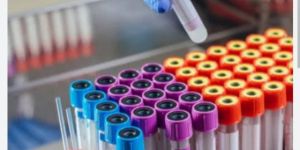 Non Vacuum Blood Collection Tube