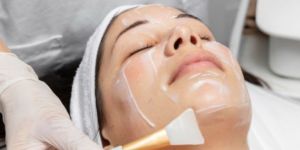 Chemical Peel