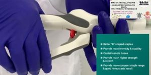 Disposable Hernia Stapler