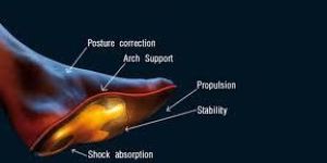 custom orthopedic insole