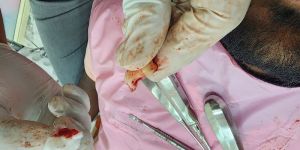 Emergency Dental Trauma Management