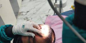 Single Tooth Implant