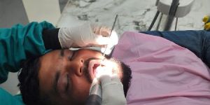 Smile Gap Closure / Diastema Correction