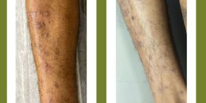 Medical Treatment Services