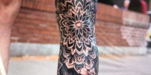 Tattoo Removal