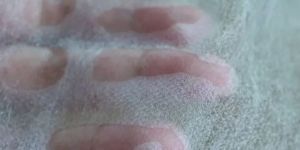 Hydrophilic Nonwoven Fabric