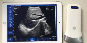 Wireless Ultrasound Scanner SY-A053CL