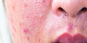 Dermatology Skin Treatment Service