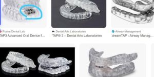 Dental Aligner