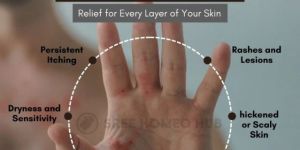 Eczema Treatment Services