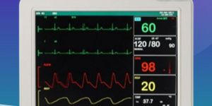CARDIAC PATIENT MONITOR