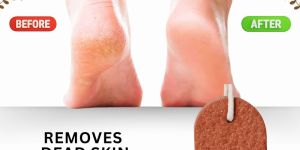 Pumice Stone Scrubber