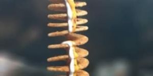 Potato Spring