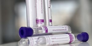 K3 EDTA Single Cap Non Vacuum Blood Collection Tube