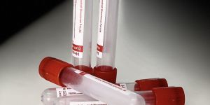Plain Non Vacuum Blood Collection Tube