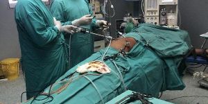 Laparoscopic Surgery