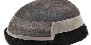 Golden Front Lace Patch