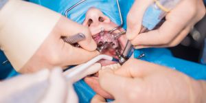 Oral Surgery