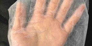 Hydrophilic Non Woven Fabric