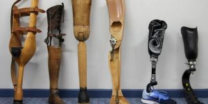 Prosthetics Foot